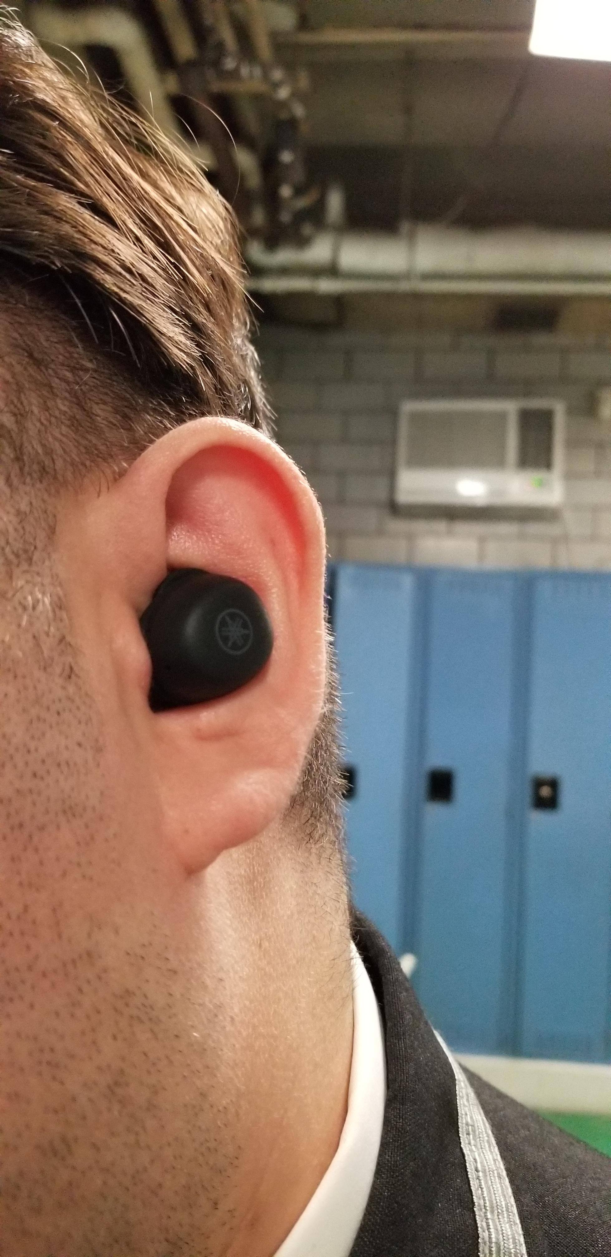 Small barely noticeable by other people, click to load a larger version