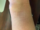 small indention where watch sits on arm, click to load a larger version