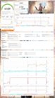 The score is good but lower than expected. Strangely 3D mark shows the CPU clock at near 5GHz but independent tools conflict with this chart., click to load a larger version