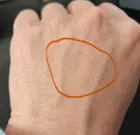 Circled area now has no hair and the surrounding area is thinned. this was a hairy place before (look bottom left of pic hand hair to see my previous thickness), click to load a larger version