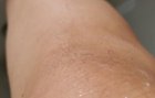 Knee hairs before., click to load a larger version