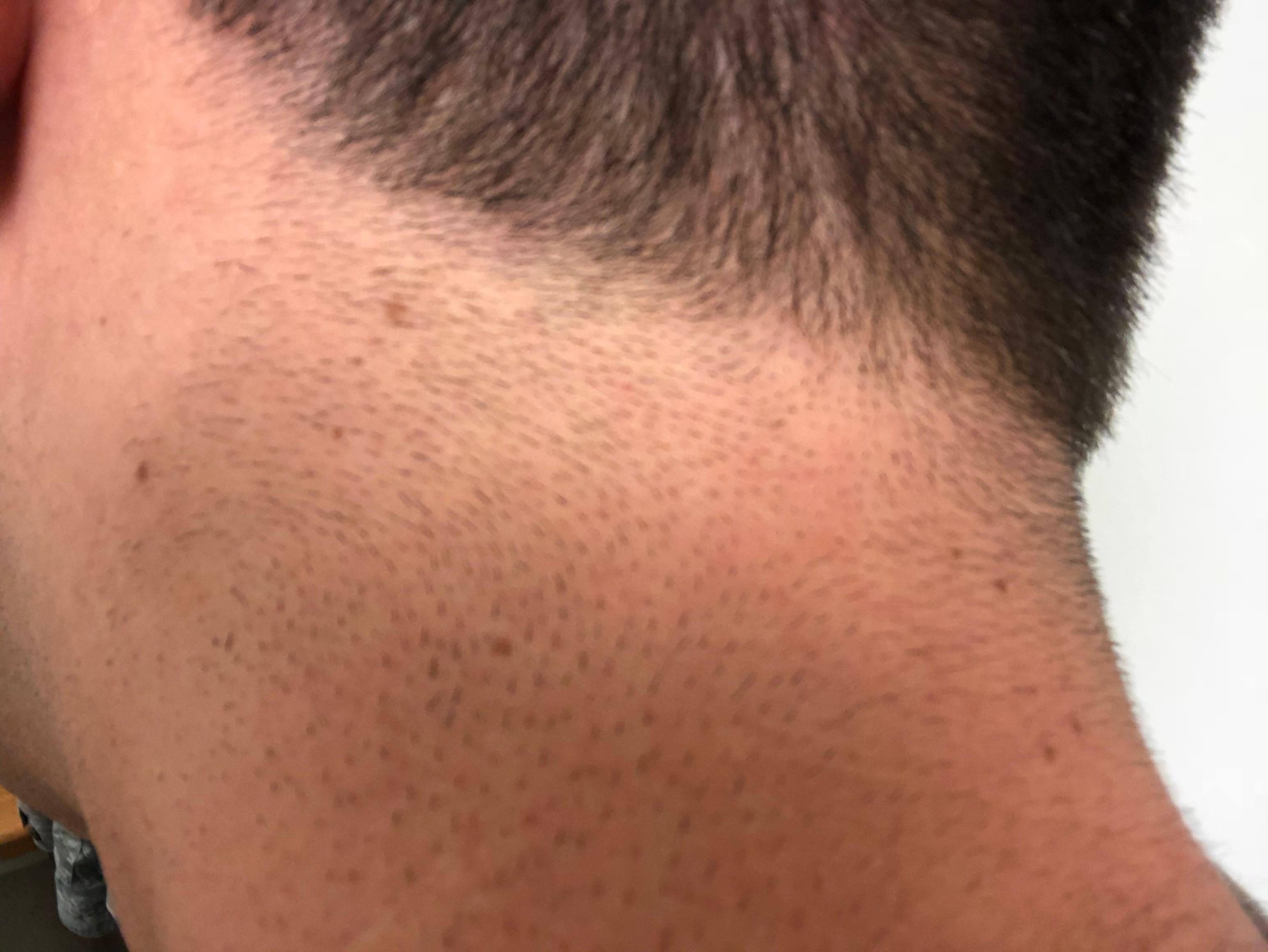 Trimmer still needs some clean-up though, click to load a larger version