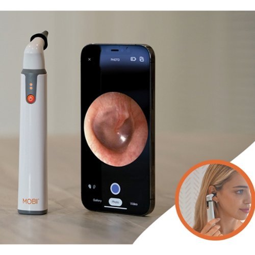 MOBI Smart Wi-Fi Otoscope 1080P HD Camera With Earwax Removal Tool - White WORLDWIDE DELIVERY