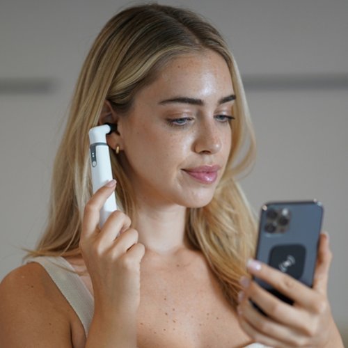 MOBI Smart Wi-Fi Otoscope 1080P HD Camera With Earwax Removal Tool - White WHERE TO BUY