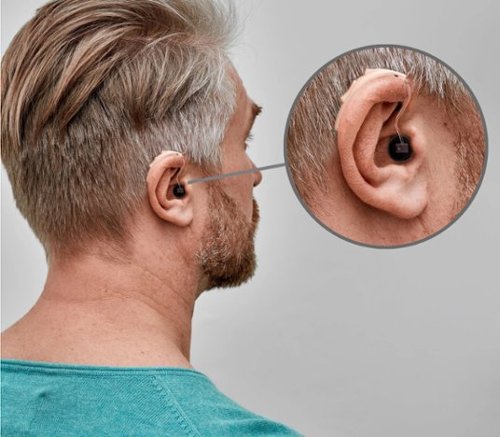 Audien Hearing Audien Ion - Beige GLOBAL SHIPPING