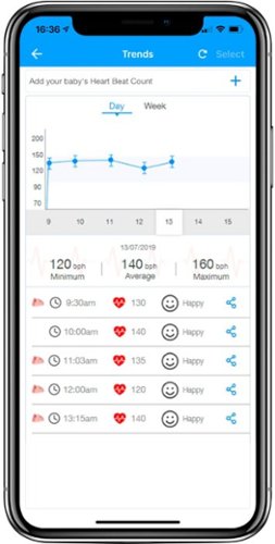 Hubble Connected Roo Fetal Heartrate Monitor - Pink WHERE TO BUY