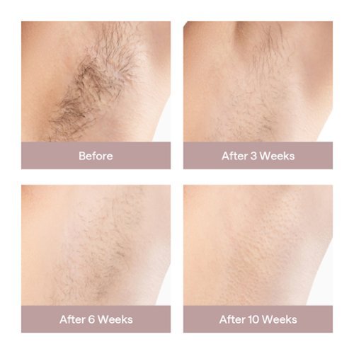 Ulike Ice Cooling At-Home Hair Removal Device Air 3 - Pink SHOP ONLINE