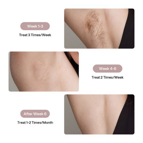 Ulike Ice Cooling At-Home Hair Removal Device Air 3 - Pink BUY ONLINE