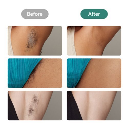 Ulike Air 2 Ice Cooling IPL Dry Hair Removal Device - Dark Green SHOP ONLINE