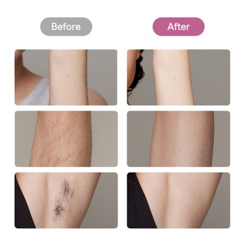 Ulike  Ice Cooling At-Home Hair Removal Device Air 10 - Pink BUY ONLINE