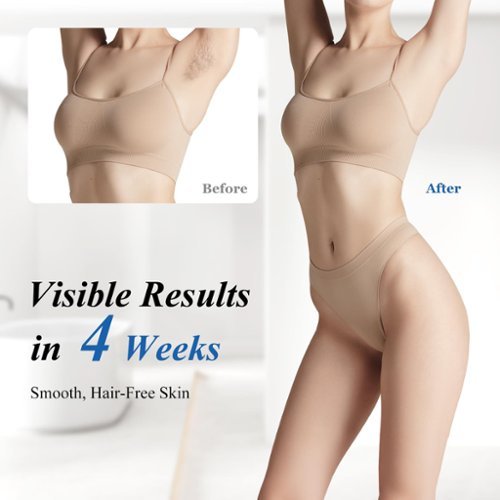 MLAY T4 IPL Laser Hair Removal for Women/Men, 15.5J Energy, Ice-Cooling Painless Tech, Effective & Long-Lasting from Home - Rose Gold BUY IN MIDDLE EAST