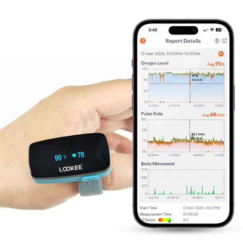 LOOKEE - LOOKEE® Ring Continuous Pulse Oximeter with Vibration Reminder for Low SpO2 & PR-Wearable Pulse Ox with Free APP Reports - Blue-Front_Standard 