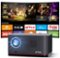 ETOE - Whale Pro 1080p FHD Projector, 1500 ANSI, Android TV 11.0 & Netflix Certified, 20W DoIby Audio, Auto Focus & Keystone - Black-Front_Standard