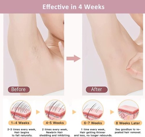 MLAY T4 IPL Laser Hair Removal for Women/Men, 15.5J Energy, Ice-Cooling Painless Tech, Effective & Long-Lasting from Home - Rose Gold BUY IN EUROPE