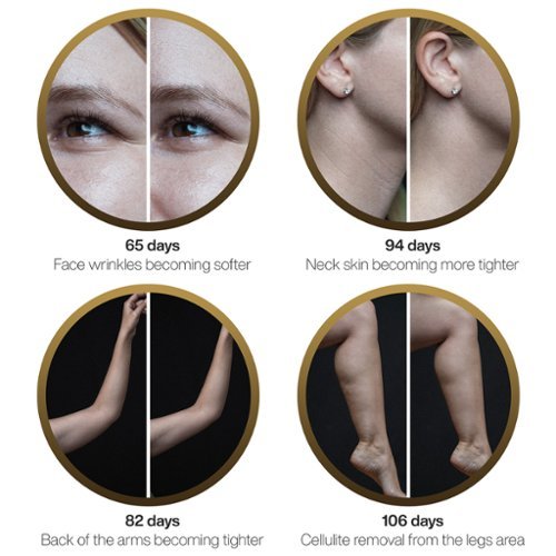 Pure Daily Care DermaWave Clinical Radio Frequency Machine - Multi WORLDWIDE DELIVERY