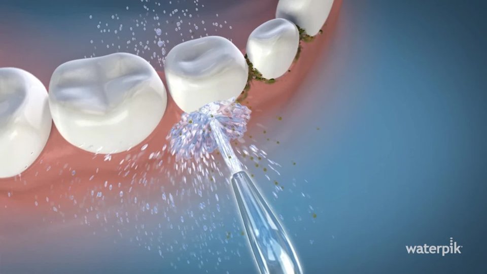 Waterpik Tips in Action video 1 minutes 00 seconds